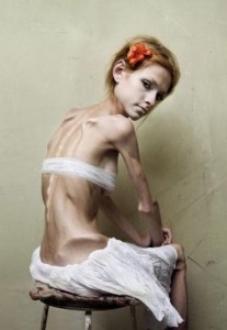 anorexica